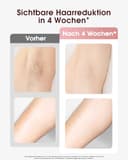 Haarlosy IPL Geräte Haarentfernung mit Kühlfunktion, 999,900 Lichtimpulse, 5 Energiestufen Schmerzfreie IPL Haarentfernung Laser Hair Removal für Frauen, Männer, Intimbereich, Körper und Beine - Rose - 3