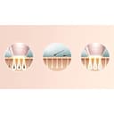 Philips BRI954/00 Lumea Prestige - Dispositivo di epilazione a luce pulsata utilizzo con o senza filo, con 3 accessori ergonomici: corpo, viso, di precisione - 4