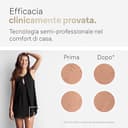 Braun Silk Expert Pro 5 Epilatore LUCE PULSATA Alternativa al laser, Ideale per Zone Sensibili, Viso, Bikini e Ascelle, 2 Accessori, Rasoio, Custodia Viaggio, Idea Regalo PL5157 Bianco e Oro - 4