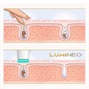 Lumineo PRO pulizia profonda del viso, spazzola per il viso con 4 accessori, silicone medicale, USB-C, impermeabile, con gel detergente abbinato per tutti i tipi di pelle PRO turchese (pelle normale) - 6