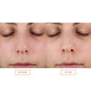 Clarisonic Testina esfoliante per il viso compatibile solo con dispositivi Mia Smart/Profile Uplift - 4