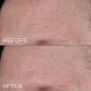 Lancôme Génifique Ultimate Dual Repair Augmented Serum & Advanced Génifique Eye Cream - Full Sized Génifique Augmented Serum 50ml & Advanced Génifique 5ml Eye Cream - 7