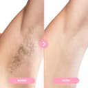 osmo epiluxe epilierer 5 - in - 1 Kabelloser Epilierer für Damen, Wet & Dry, Langanhaltende Haarentfernung, Weißer Epiliergerät für Gesicht und Körper - 2