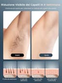 Epilatore Luce Pulsata con Funzione di Raffreddamento a Ghiaccio, Schermo LCD Touch,Modalità di Scorrimento Automatico, Epilatore a Luce Pulsata per Donne e Uomini,Viso, Ascelle, Bikini,Corpo, Bianco - 7