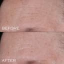 Lancôme Génifique Ultimate Dual Repair Augmented Serum & Advanced Génifique Eye Cream - Full Sized Génifique Augmented Serum 30ml & Advanced Génifique 5ml Eye Cream - 7