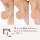 Philips Lumea IPL 9900 Series Haarentfernungsgerät mit SenseIQ & SkinAI Technologie – Alternative zur Laserhaarentfernung – 2 Aufsätze für Körper & Gesicht (BRI950/02) - 4