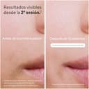 Braun Luz Pulsada Silk-expert Pro 5, Alternativa a Depiladora Laser, Eliminación Del Vello En Casa, Depiladora IPL Con Funda y 2 Cabezales Para Cara y Cuerpo, Blanca/Dorada, PL5140 - 3