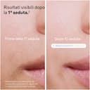 Braun Skin I·Expert Epilatore Luce Pulsata Smart, Depilatore Corpo Donna, Alternativa Laser Peli Donna, Include Pochette, Rasoio Venus, Luce Pulsata Braun, 4 Testine Viso E Corpo, PL7387 - 4