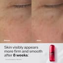 Shiseido Ultimune Power Infusing Serum 4,0 30 Ml - 5