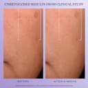 LANCÔME RÉNERGIE H.C.F. Triple serum 50 ml - 4