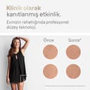 Braun IPL Silk-Expert Pro 5 PL5242 Haarentfernung für Zuhause, Weiß/Gold, Alternative zur Laser-Haarentfernung, mit Etui, Venus-Rasiersystem, 3 Köpfe, Geschenk für Frauen - 5