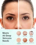 TOUCHBeauty Spazzola Elettrica Viso 4X più Efficace, 3 Spazzole Intercambiabili, 2 Velocità, Pulsazione Sonica, IPX7 Impermeabile con Custodia, per Punti Neri, Pelli Grasse (Morgentau Lichtgrün) - 5