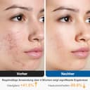 Rkdely Spazzola Pulizia Viso, 3-In-1 Massaggiatore Viso con EMS e riscaldamento, Spazzola Viso Elettrica con 4 Testine Intercambiabili per Pulizia Profonda, Per Detergere In Profondità (Rosa) - 5