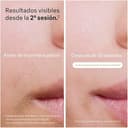 Braun Luz Pulsada Silk-expert Pro 5, Alternativa a Depiladora Laser, Eliminación Del Vello En Casa, Depiladora IPL Con Funda, Maquinilla Venus, 4 Cabezales Para Cara y Cuerpo, Blanca/Dorada, PL5358 - 3