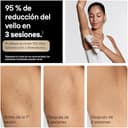 Braun Depiladora Luz Pulsada Silk·expert Pro 5, IPL, Depilación Láser En Casa Para Cara Y Cuerpo, Reducción Permanente Del Vello, Depiladora Laser Con 2 Cabezales, Neceser y Maquinilla Venus, PL5234 - 5