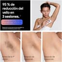 Braun Depiladora Luz Pulsada Smart IPL Skin i·expert, Depiladora Laser con 4 Cabezales, Neceser Y Maquinilla Venus, Reducción Permanente del Vello, Depilación Láser en Casa, PL7431, Blanco/Bronce - 6