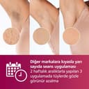 Philips Lumea Advanced BRI924/00 - Depilación con luz (Rosa, Blanco, Luz pulsada intensa (IPL), 15 min, 2,5 min, 4 min, 2 min) - 4