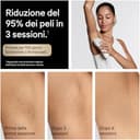 Braun Silk·expert Pro 5, Epilatore Luce Pulsata Smart, Epilazione Laser Peli Donna A Casa, Riduzione Permanente Dei Peli, Con 2 Testine, Custodia E Rasoio Gillette Venus, PL5234 - 4